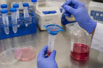 Single-cell suspension being prepared after tissue dissociation and filtering in a Karnataka biotech lab