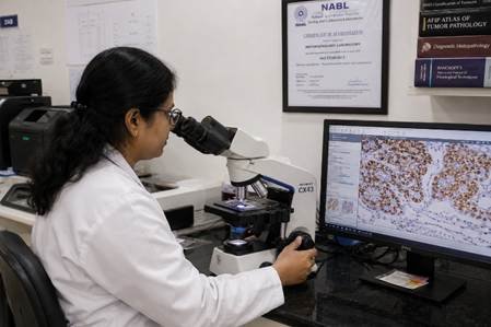 Indian pathologist reviewing immunohistochemistry-stained slides on a binocular microscope in a Karnataka cancer diagnostics lab
