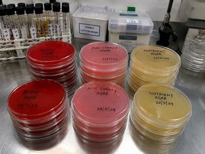 Set of culture media microbiology plates including blood and MacConkey agar in a Bangalore clinical lab